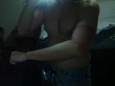 The sunscreen works great as long as you get it everywhere.