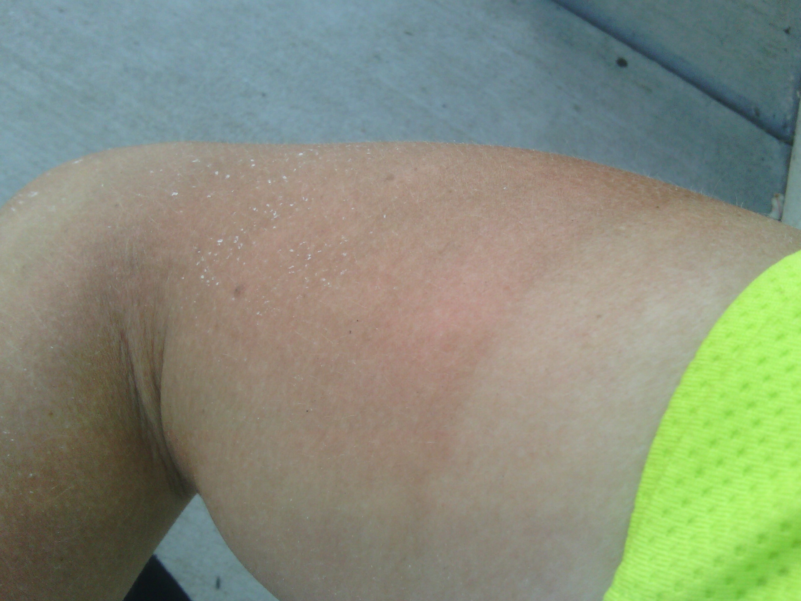 These little salt crystals actually develop on my arms after a few hours of riding.
