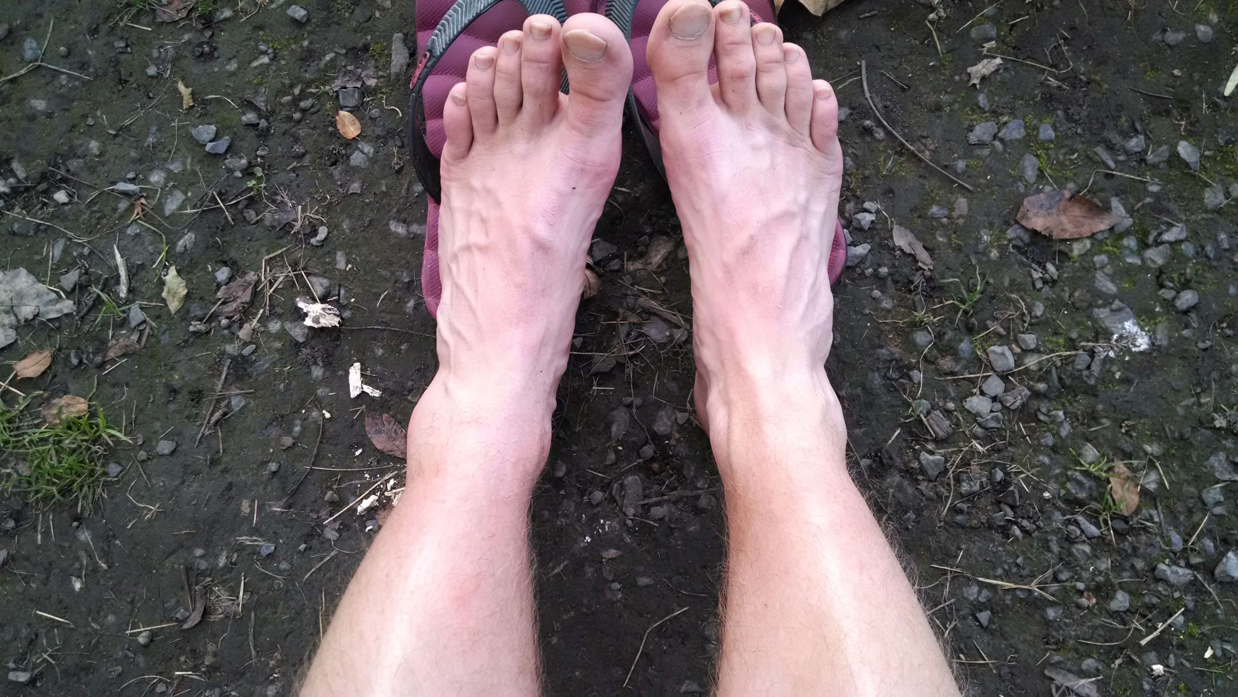 Since a few people were worried (and for consistency with the last trip) here is a comparative ankle shot.