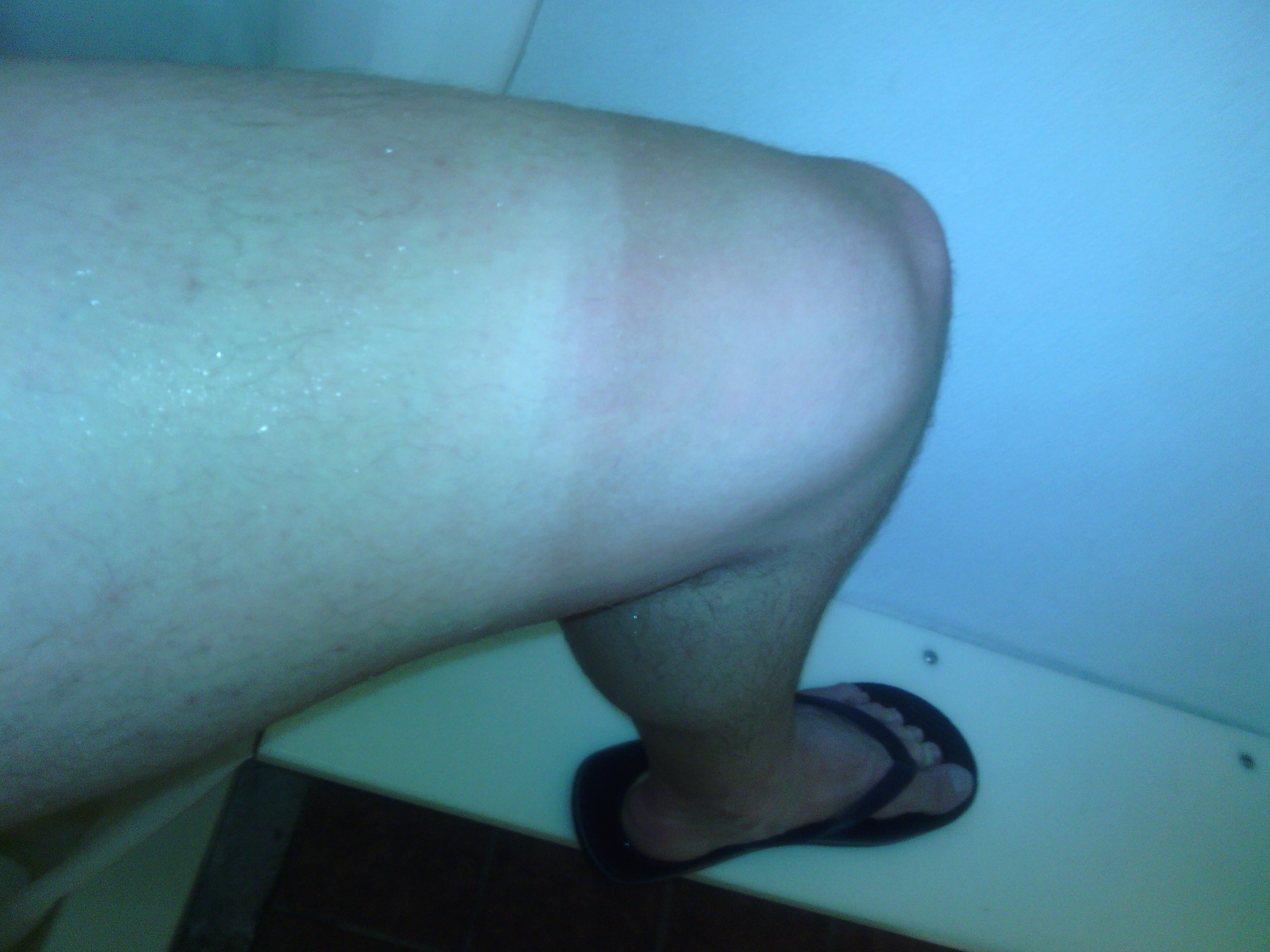 I&rsquo;m developing some tan lines